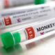 Monkeypox Cases In Nigeria: NCDC Confirms 21, One Death