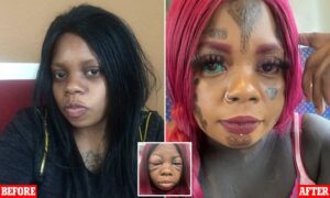 Anaya Peterson: Mother Who Tattooed Her Eyeballs Blue And Purple Is Going Blind