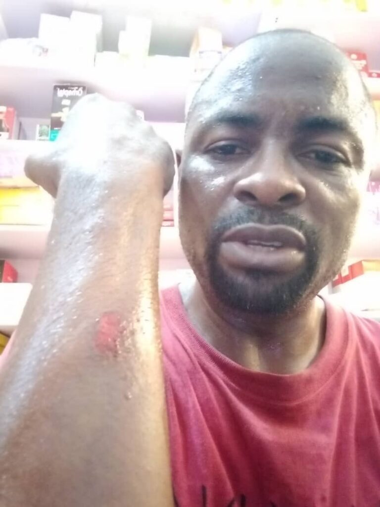 Multiple Injuries Reported in Attack on Peter Obi's Supporters in Lagos