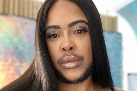 How To Stop Facial Hair Growth In Females Naturally: 10 Tips For Hirsutism Cures