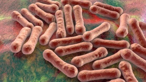 Diphtheria Cases In Nigeria 2023: Causes, Symptoms, Treatment, Diagnosis